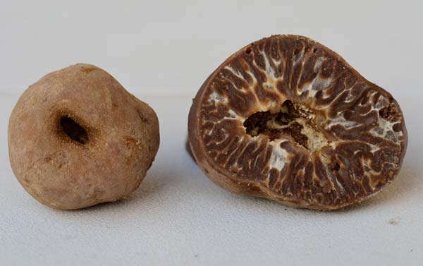 TUBER excavatum